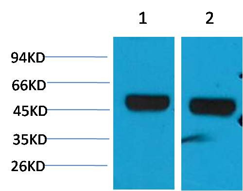 Anti-beta 1 Sodium Potassium ATPase