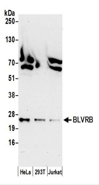 Anti-BLVRB/Biliverdin reductase B