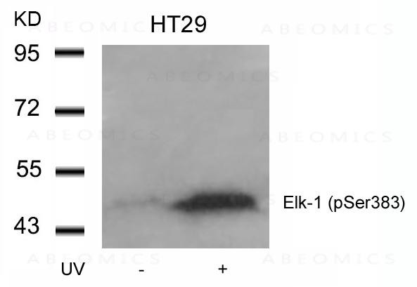 Anti-phospho-Elk-1 (Ser383)