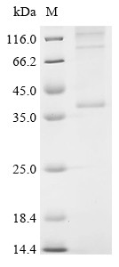 Cannabinoid receptor 2 (Cnr2), mouse, recombinant