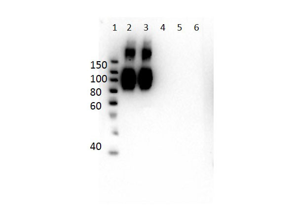 Anti-Hemoglobin A (beta chain), clone 14G2.G11.F11