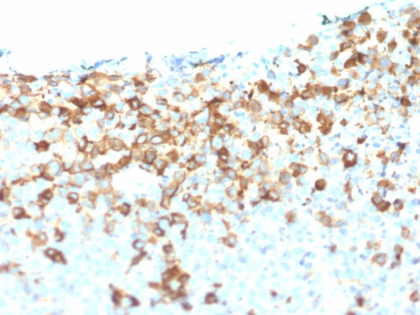 Anti-NGF-Receptor (p75) / CD271 (Soft Tissue Tumor Marker) (NGFR/1964), CF405S conjugate, 0.1mg/mL