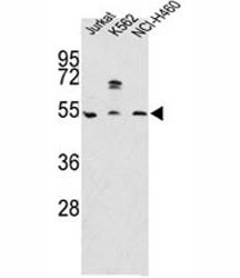 Anti-APOA4