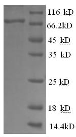 Glucose-6-phosphate isomerase (GPI), partial, human, recombinant