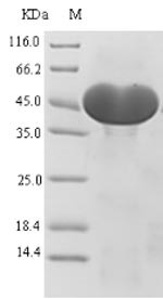 ATP-citrate synthase (ACLY), partial, human, recombinant