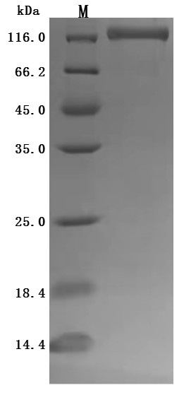 Ectonucleotide pyrophosphatase/phosphodiesterase family member 3 (ENPP3), partial (Active), human, r