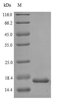 Proliferation marker protein Ki-67 (MKI67), partial, human, recombinant