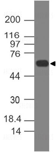 Anti-Human CD19 (Clone: CB19)