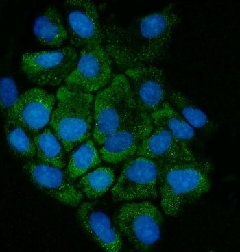 Anti-Cystathionase (Cystathionine gamma lyase)