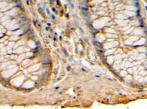 Anti-Histamine Receptor H1, C-terminal