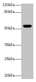 Anti-CHRNA1