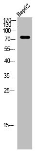 Anti-SLC25A12