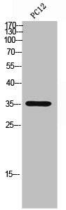 Anti-ATP1B3