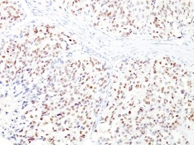 Anti-Microphthalmia Transcription Factor (MITF)(D5 + MITF/915)