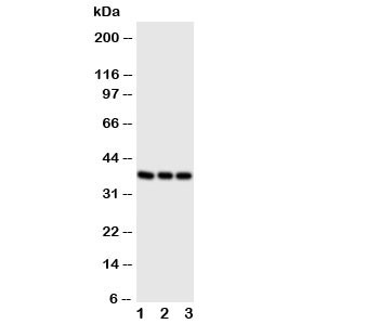 Anti-CD1a