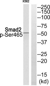 Anti-Phospho-SMAD2 (Ser465)