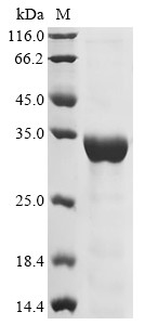 NAD-dependent protein deacetylase sirtuin-3 (Sirt3), partial, mouse, recombinant