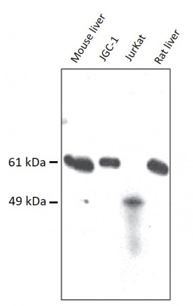 Anti-SOAT2 / ACAT2