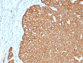 Anti-Cytokeratin 5 / KRT5, clone KRT5/4245R