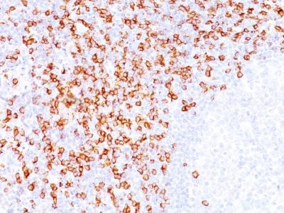 Anti-CD8A (Cytotoxic / Suppressor T-Cell Marker)(Clone: C8/144B)