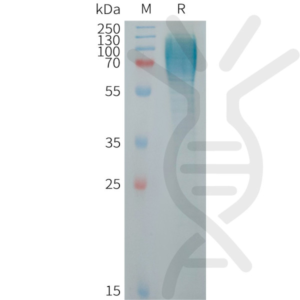 Human ICAM3 Protein, His Tag