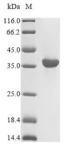 HLA class I histocompatibility antigen, A alpha chain (HLA-A),partial, human, recombinant