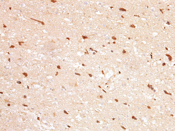 Anti-IDH1 R132H Monoclonal Antibody (Clone:IHC132)