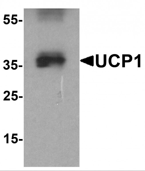 Anti-UCP1