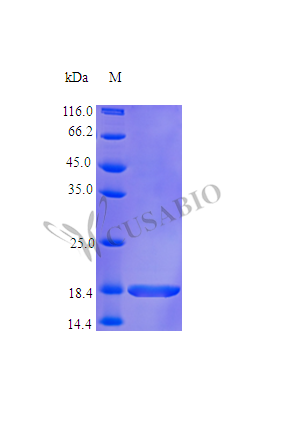 Granulocyte colony-stimulating factor protein (CSF3), partial (Active), human, recombinant