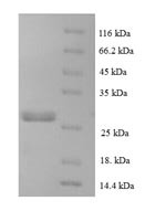 C-C motif chemokine 16 (CCL16), human, recombinant