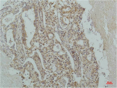 Anti-NFKBIB Monoclonal