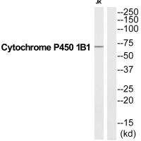 Anti-CYP1B1