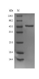 Alpha-1-antiproteinase (Serpina1), rat, recombinant