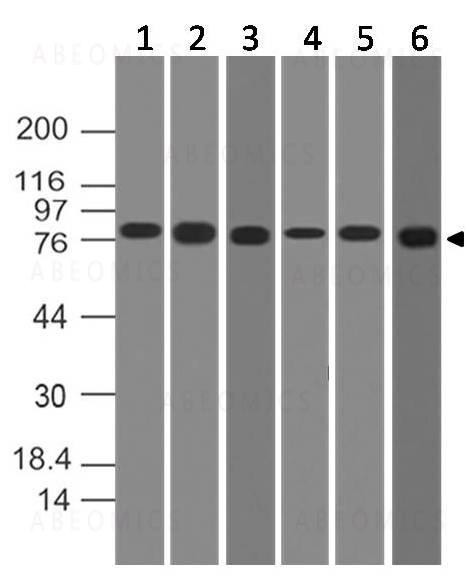 Anti-IKK alpha (Clone: ABM10G9)