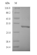 NAD (P)H dehydrogenase [quinone] 1 (Nqo1), mouse, recombinant