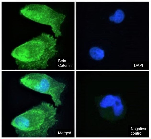 Anti-beta Catenin