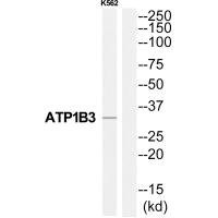 Anti-ATP1B3