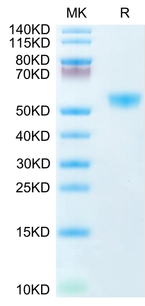 Human CD28H/IGPR-1 Protein