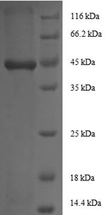 Insulin-like growth factor I (IGF1), human, recombinant