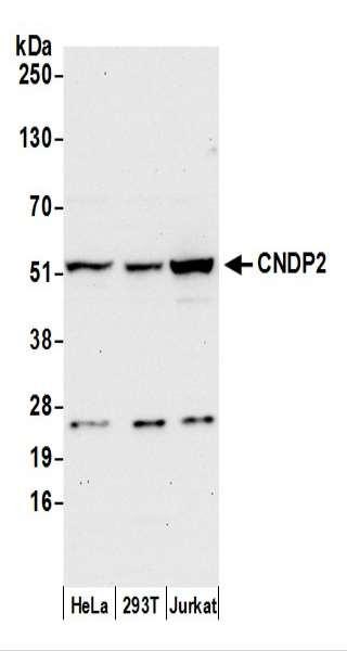 Anti-CNDP2