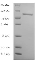 Thioredoxin reductase 1, cytoplasmic (TXNRD1),partial, human, recombinant