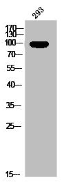 Anti-Phospho-PGR (S400)