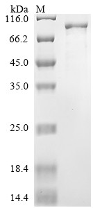 Replicase polyprotein 1ab (rep), Severe acute respiratory syndrome coronavirus 2, recombinant