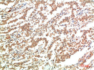 Anti-JAK2 Monoclonal