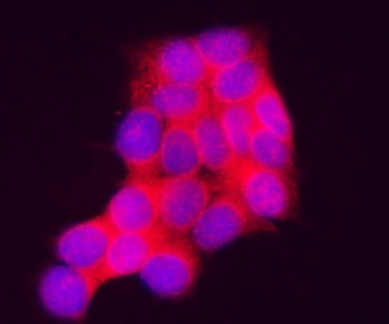 Anti-INPP4A / Inositol polyphosphate-4-phosphatase type I A