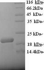 B-lymphocyte antigen CD20 (MS4A1), partial, human, recombinant