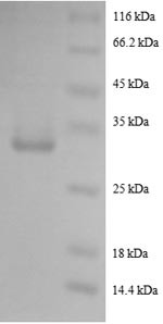 Pro-epidermal growth factor (EGF), partial, human, recombinant