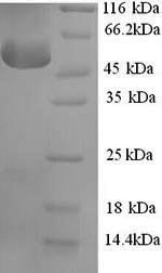 Corticosteroid-binding globulin (SERPINA6), human, recombinant