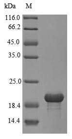 Sortilin (Sort1), partial, rat, recombinant