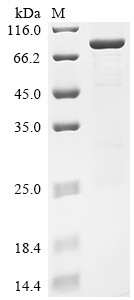 Receptor-interacting serine/threonine-protein kinase 2 (RIPK2), human, recombinant